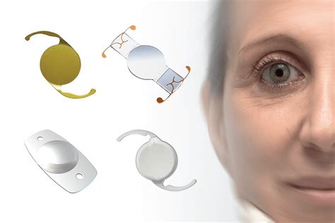 cataract are replacement lens generic